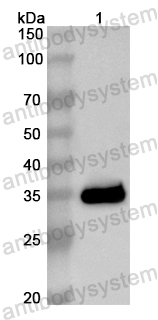 Anti-Human SCGB1D1 Polyclonal Antibody