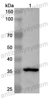 Anti-Human SCGB1D2 Polyclonal Antibody