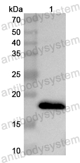 Anti-Human NUDT3 Polyclonal Antibody