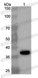 Anti-Human MOCS2 Polyclonal Antibody