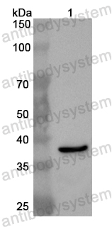 Anti-Human CYB5A Polyclonal Antibody