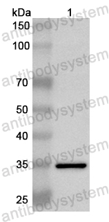 Anti-Human MOS Polyclonal Antibody