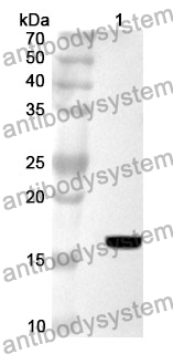 Anti-VIP Polyclonal Antibody