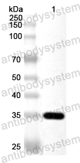 Anti-Human PPY Polyclonal Antibody