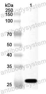 Anti-COL1A1 Polyclonal Antibody