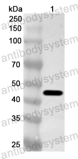 Anti-PIIICP/COL3A1 Polyclonal Antibody