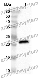Anti-CRYAB Polyclonal Antibody