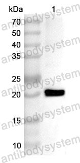 Anti-Human TNNC2 Polyclonal Antibody