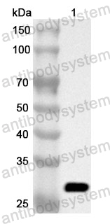 Anti-Human FGA Polyclonal Antibody