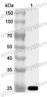 Anti-Human MT-ND2 Polyclonal Antibody