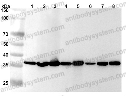 Anti-Human GAPDH Polyclonal Antibody