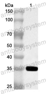 Anti-Human RPLP2 Polyclonal Antibody