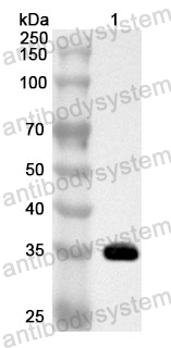 Anti-Human RPLP0 Polyclonal Antibody