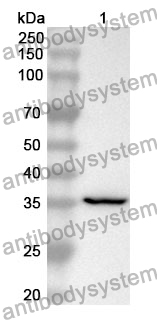 Anti-SERPINA7 Polyclonal Antibody