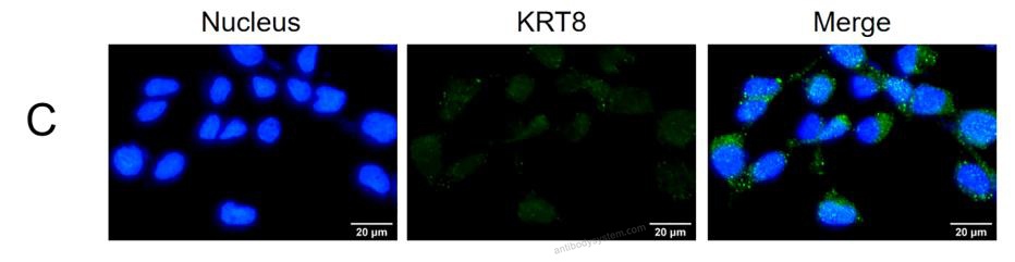 Immunofluorescence for Anti-KRT8/CK-8 Polyclonal Antibody ?>