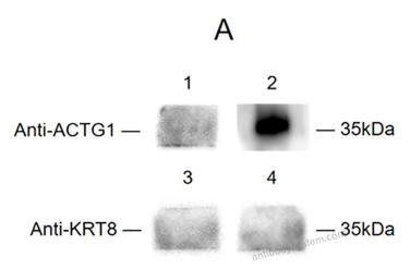 Western Blot for Anti-KRT8/CK-8 Polyclonal Antibody ?>