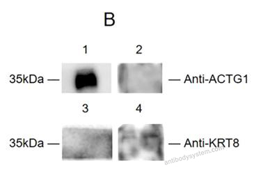 Western Blot for Anti-KRT8/CK-8 Polyclonal Antibody ?>