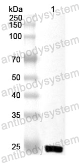 Anti-Human CRYBA1 Polyclonal Antibody