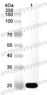 Anti-Human CD5 Polyclonal Antibody