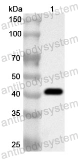 Anti-Human UROD Polyclonal Antibody