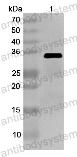 Anti-Human LCK Polyclonal Antibody