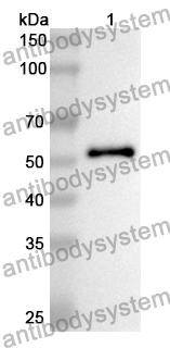 Anti-Human ATP5F1B Polyclonal Antibody