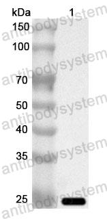 Anti-Human CENPB Polyclonal Antibody