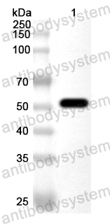 Anti-Human CD141/THBD Polyclonal Antibody