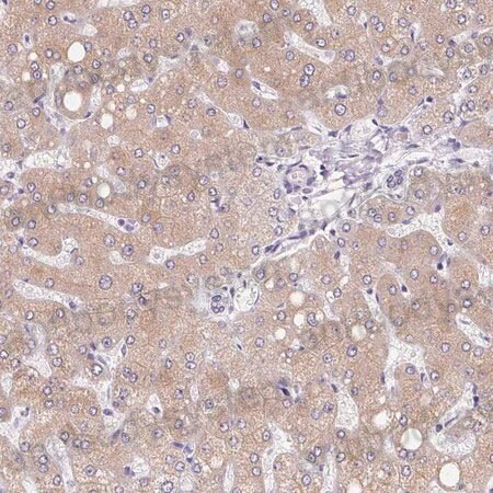 Immunohistochemical for Anti-Human ASGR2 Polyclonal Antibody ?>