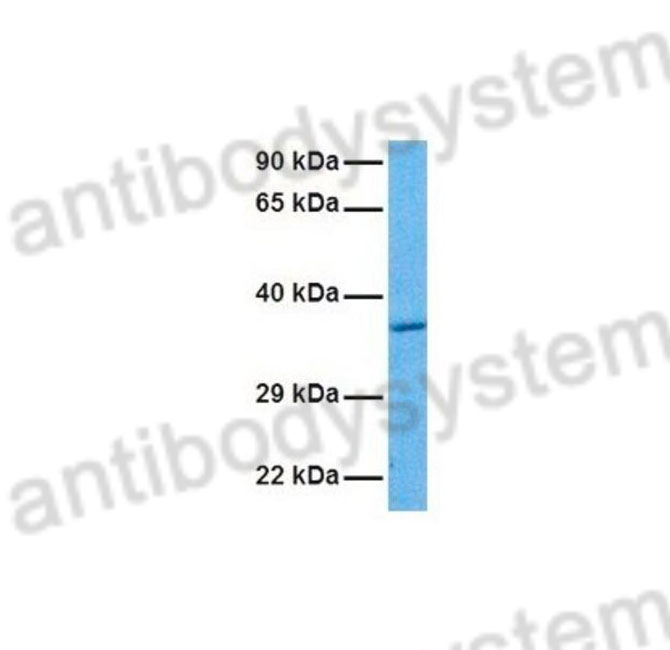 Western Blot for Anti-Human ASGR2 Polyclonal Antibody ?>