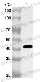 Anti-Human C8A Polyclonal Antibody