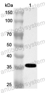 Anti-Human GALT Polyclonal Antibody