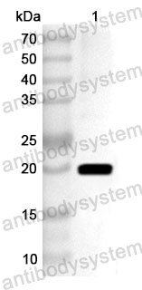 Anti-Human HNRNPC Polyclonal Antibody