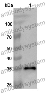 Anti-ERCC1 Polyclonal Antibody