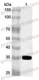 Anti-Human SRPRA Polyclonal Antibody