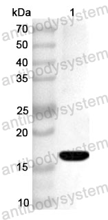 Anti-Human SNRNP70 Polyclonal Antibody