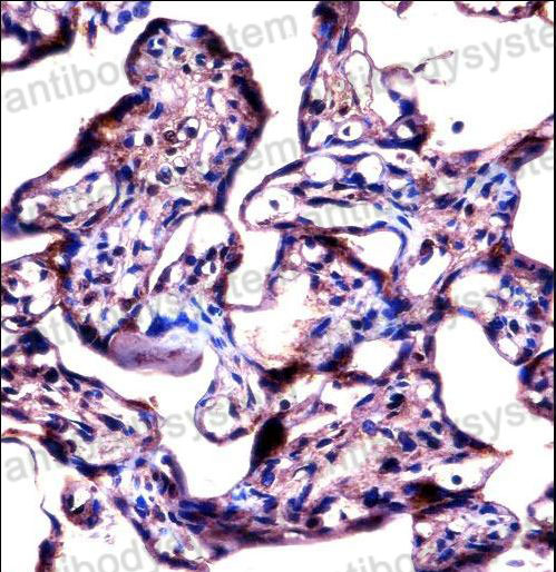 Immunohistochemical for Anti-Human STS Polyclonal Antibody ?>