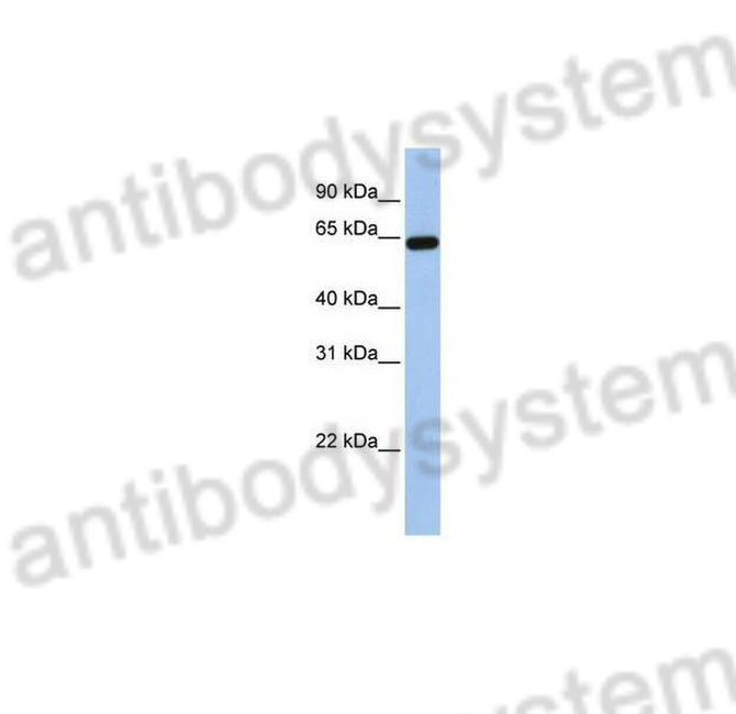 Western Blot for Anti-Human STS Polyclonal Antibody ?>
