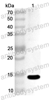 Anti-Human SNRPA Polyclonal Antibody