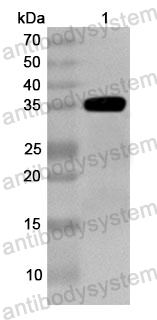 Anti-Human TNP1 Polyclonal Antibody