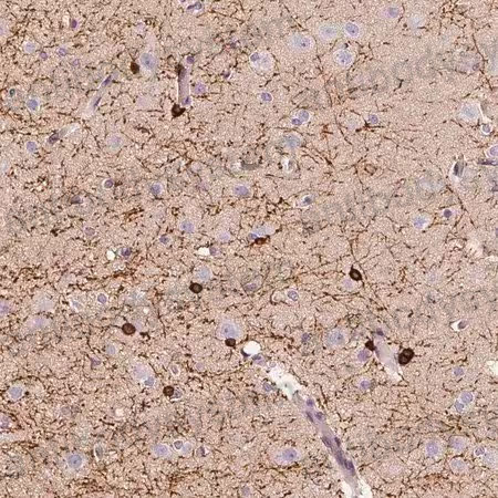 Immunohistochemical for Anti-Human CNP Polyclonal Antibody ?>