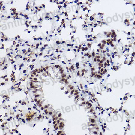 Immunohistochemical for Anti-Human SNRPA1 Polyclonal Antibody ?>