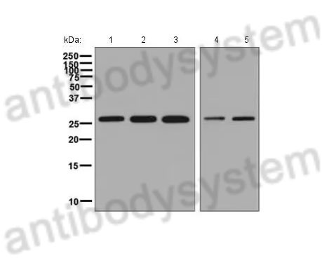 Western Blot for Anti-Human SNRPA1 Polyclonal Antibody ?>