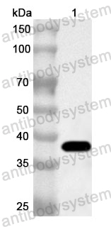 Anti-Human LCT Polyclonal Antibody