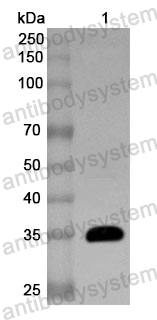 Anti-Human C4d Polyclonal Antibody