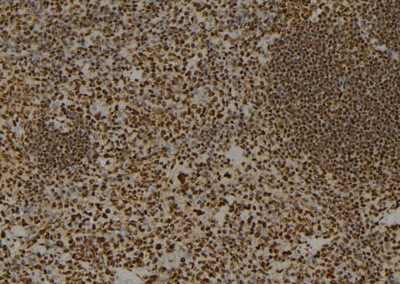 Immunohistochemical for Anti-Human H2AZ1 Polyclonal Antibody ?>