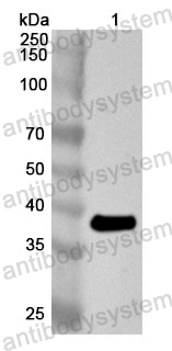 Anti-Human TFPT Polyclonal Antibody