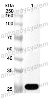 Anti-Human FBXO45 Polyclonal Antibody