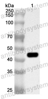 Anti-Human ZNF688 Polyclonal Antibody