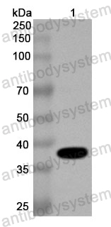 Anti-Human JMJD7 Polyclonal Antibody